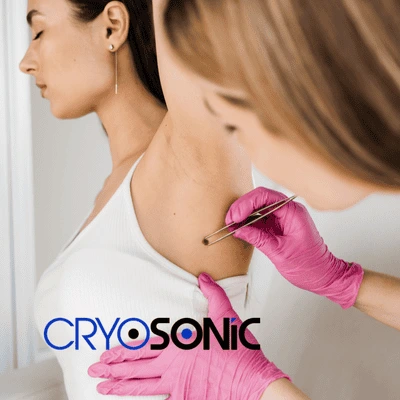 With cryosonic you can book for treatment even in your own home! Cambridge